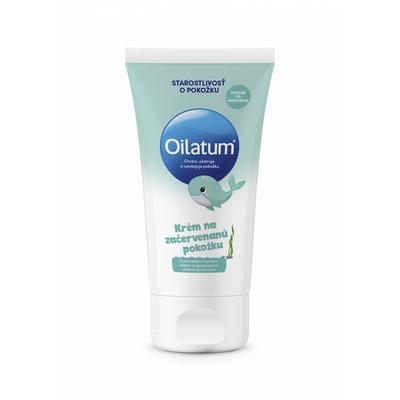 KRÉM OILATUM NA ZAČERVENANÚ POKOŽKU 100ml